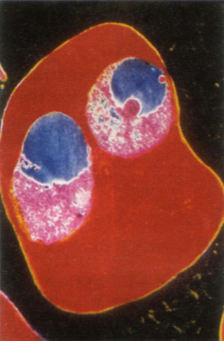 adattata da NATURA, Einaudi Scuola – plasmodi della malaria in un globulo rosso